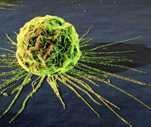 Cancer : le nouvel appétit des laboratoires pour un marché à 185 milliards de dollars