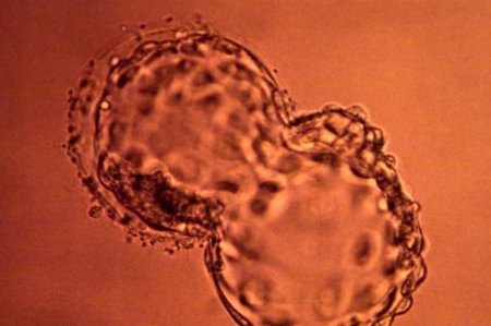 L’«édition génétique» d’embryons humains inquiète