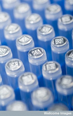 Médecine personnalisée: un projet prometteur de biobanque