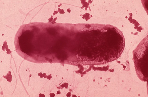 Nouvelle piste dans la recherche contre les infections nosocomiales