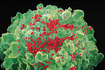 VIH: des généticiens cartographient les résistances humaines au sida