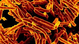 Tuberculose – l’EPFL crée une fondation pour lancer son antibiotique