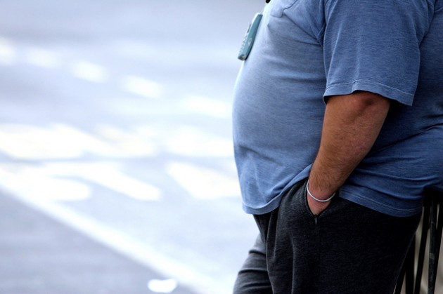 Surpoids et obésité réduiraient l’espérance de vie de 1 à 10 ans