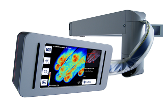 Novadaq announces definitive agreement to acquire Aimago SA