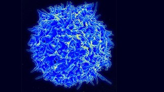 33 millions pour Anokion, la start-up qui rééduque le système immunitaire