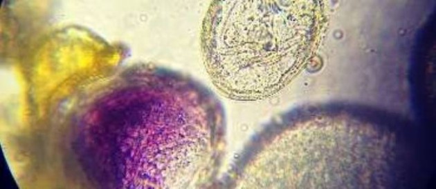 Résistance aux antibiotiques : l’OMS tire la sonnette d’alarme