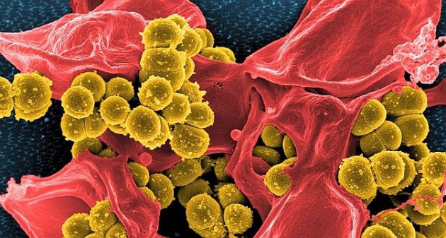 Des antibiotiques suisses prometteurs