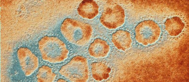 Un scientifique fabrique un virus mortel