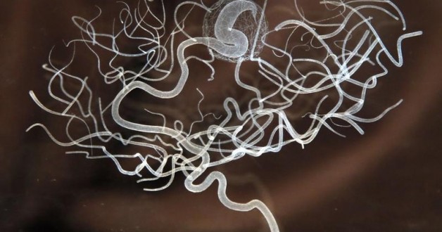 Will we ever understand the human brain?