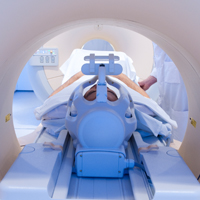 La technique par IRM détecte le déclin cognitif avant l’apparition des symptômes