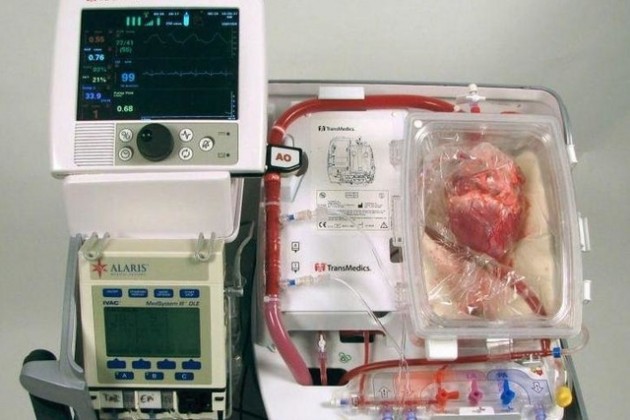 Des médecins greffent des cœurs ayant cessé de battre