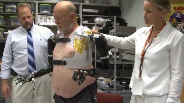 Un homme équipé de deux bras bioniques: une première