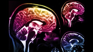 Un nouvel outil pour mieux comprendre la maladie de Parkinson