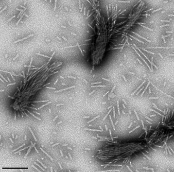 La forme fibrillaire à l’origine de la maladie de Parkinson a été identifiée