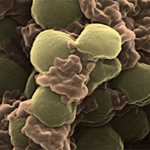 A new antibiotic treatment by disguising nanoparticles with coverings of platelets