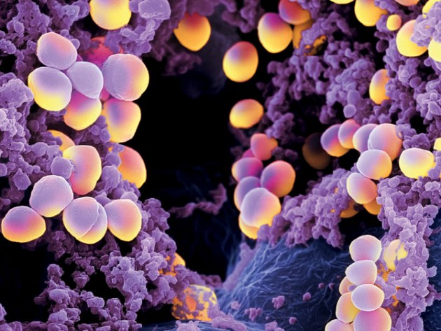 Un espoir de traitement contre l’infection à staphylocoque doré