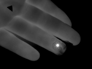 New wearable device can measure your blood flow