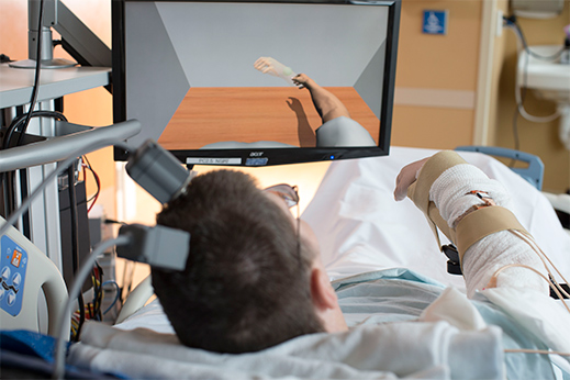 Paralyzed man’s arm wired to receive brain signals