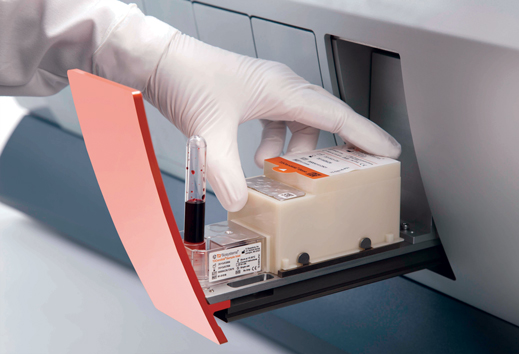 New sepsis detector shrinks the diagnosis from days to hours