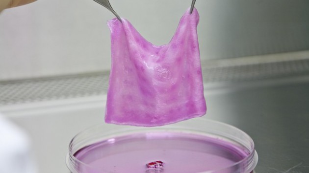 Des pansements anti-infectieux pour soigner les grands brûlés