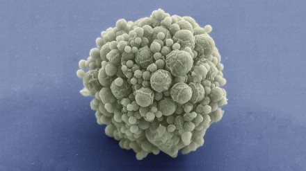 Voici Syn 3.0, le microbe composé du plus petit génome au monde