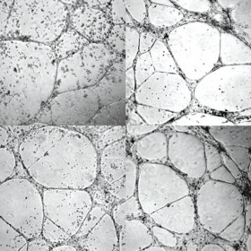 Injectable Gel Generates New Blood Vessels
