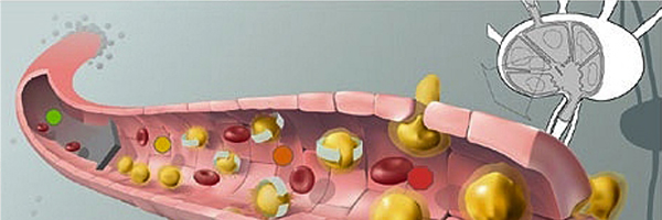 Blocking the migration of cancer cells to destroy them