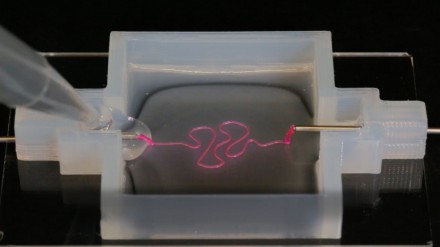 3-D-Printed Kidney Parts Just Got Closer to Reality