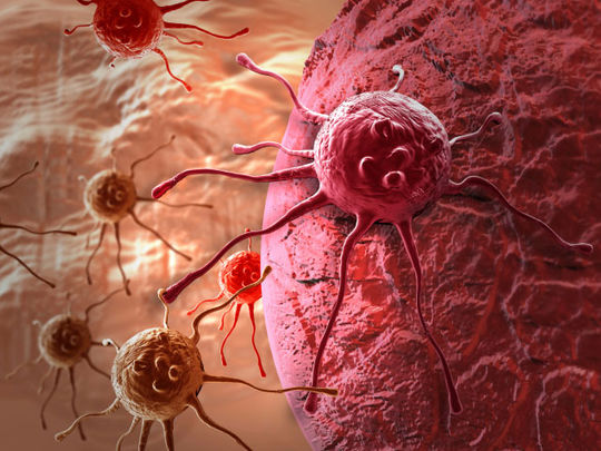 Vers un registre national des maladies oncologiques