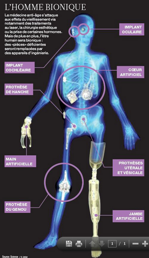 Des implants très prisés en Suisse