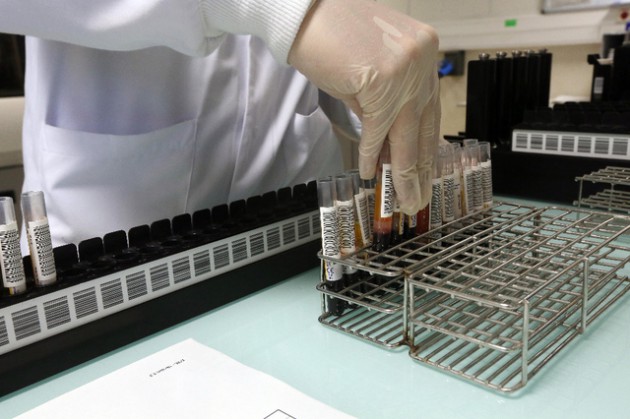 Hépatite B et C : la Suisse offre le dépistage