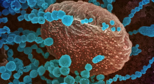 La biotech romande se profile dans les tests sérologiques