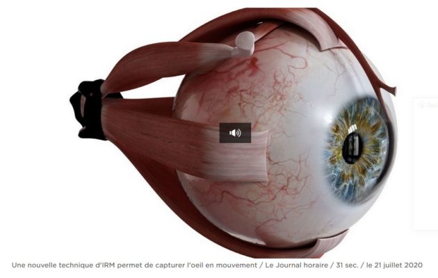La recherche lausannoise prête à révolutionner l’imagerie de l’œil