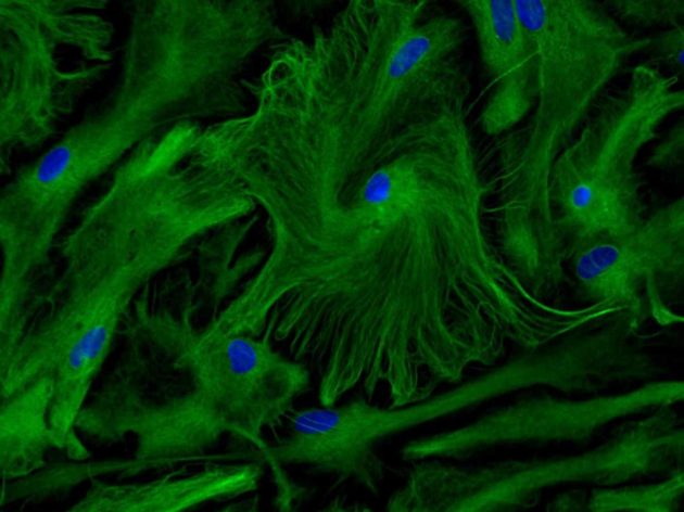 Les astrocytes, gardiens de la plasticité cérébrale