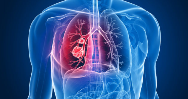 Domo Health and Roche develop a digital health solution to detect the first signs of respiratory infections