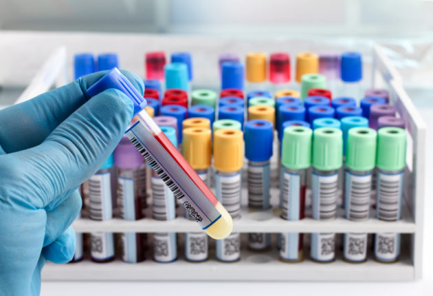 Des analyses médicales jusqu’à 31 fois plus chères en Suisse