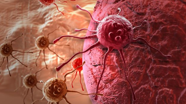 L’origine des métastases post-chimiothérapie mieux comprise