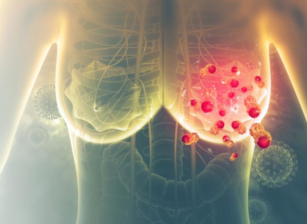 Un mécanisme favorisant les métastases du cancer du sein identifié par des chercheurs suisses et finlandais