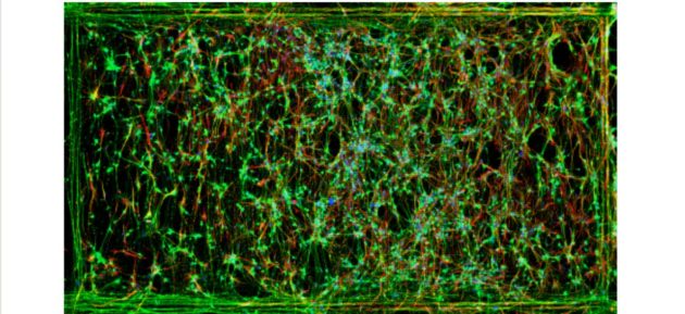 Promising new tool for uncovering key characteristics of neurodegenerative diseases