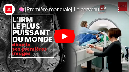Première mondiale : le cerveau dévoilé comme jamais grâce à l’IRM le plus puissant au monde