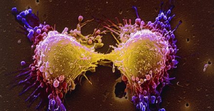 Combattre le cancer en affamant les cellules dormantes: une nouvelle piste découverte dans la lutte contre la leucémie