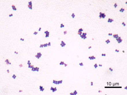 LimmaTech franchit un cap : un vaccin innovant contre Staphylococcus aureus entre en phase clinique