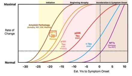 Un simple test sanguin capable de prédire Alzheimer plus de 20 ans avant les premiers symptômes ?