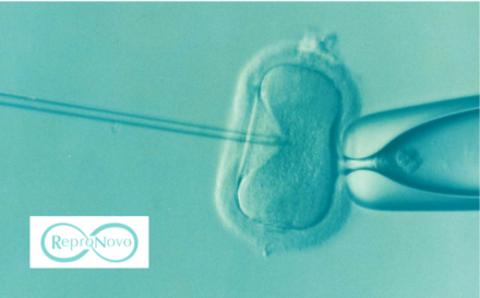 ReproNovo lève 65 millions de dollars pour accélérer ses thérapies en médecine reproductive
