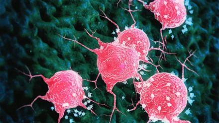 Le fer : une nouvelle cible contre les cancers les plus agressifs