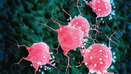 Le fer : une nouvelle cible contre les cancers les plus agressifs