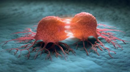 Dépistage précoce du cancer par test sanguin : prometteuse mais encore incertaine