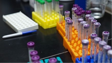 EvlaBio lève 21 millions d’euros pour traiter l’hypertrophie ventriculaire liée à l’insuffisance rénale