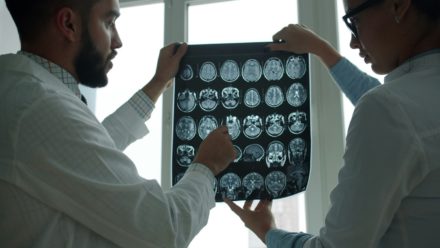 Plus de 3 milliards de personnes affectées : les troubles neurologiques, une urgence mondiale