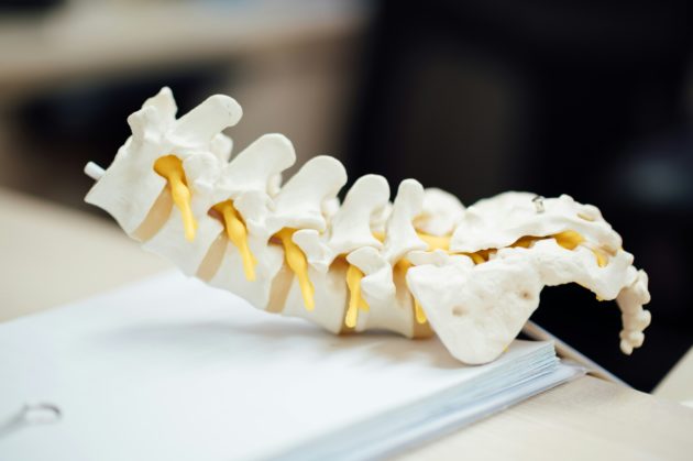 Spineart lève CHF 25 millions pour accélérer son expansion internationale